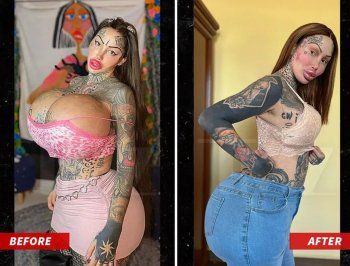 شاهد .. بالصورة - هذا ما فعلته ماري مجدلين بعد إنفجار ثديها