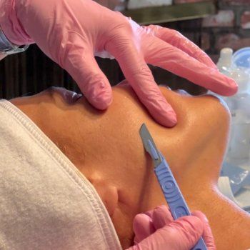 شاهد .. بالصورة - إيفا منديز تعاني من الشعر الكثير وتحلق وجهها كل يوم