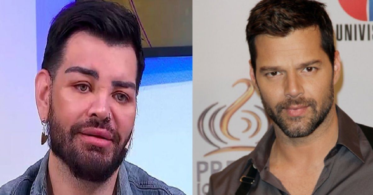 شاهد .. معجب يخضع لـ 40 عملية تجميل ليصبح شبيه ريكي مارتن وما حصل بعدها لم يكن بالحسبان!