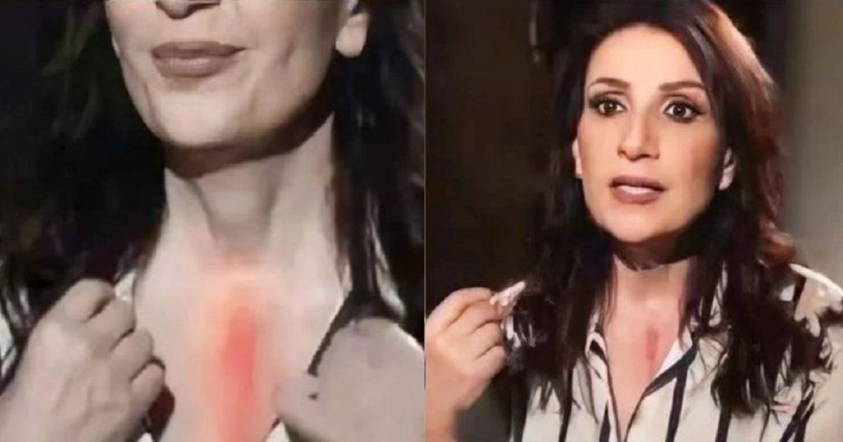 شاهد .. بالفيديو- وفاء موصللي تتحدث لأول مرة عن خضوعها لـ عملية خطيرة وتكشف عن جرحها الكبير