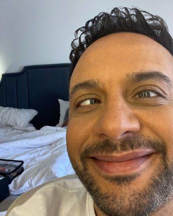 شاهد .. مصطفى قمر يطمئن الجمهور على عينه المُصابة ولكن هناك مشكلة جديدة!