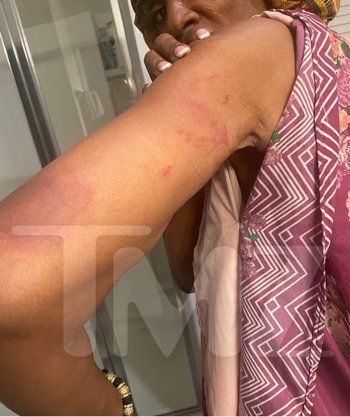 شاهد .. بالصور - ممثلة شهيرة تتعرض لحادث سير مروع