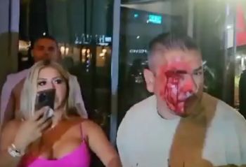 شاهد .. بالصور- إحتفال ليونيل ميسي وديفيد بيكهام ينتهي بضرب مبرح في مطعم بميامي