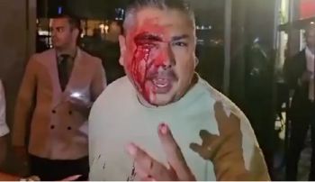 شاهد .. بالصور- إحتفال ليونيل ميسي وديفيد بيكهام ينتهي بضرب مبرح في مطعم بميامي