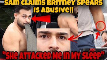 شاهد .. سام أصغري: "بريتني سبيرز ضربتني وأنا نائم".. وصور مفاجئة تؤكد كلامه