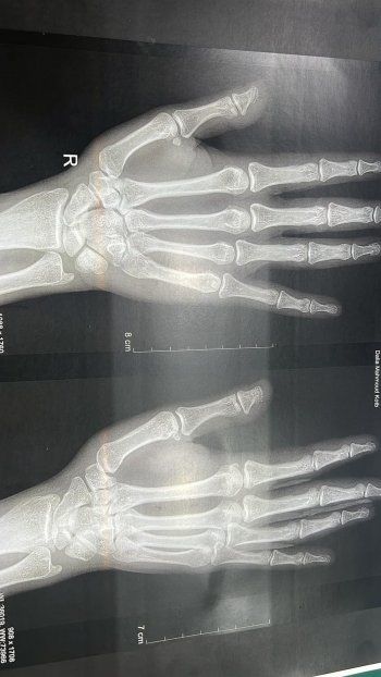 شاهد .. بالصور- داليا البحيري تتعرض لحادث خلال مسرحية "سيدتي أنا" وتطمئن الجمهور بهذه الكلمات