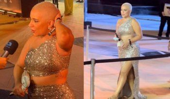 شاهد .. أول ظهور لـ أسما شريف منير بعدما حلقت شعرها - بالصور