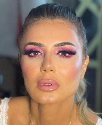 شاهد .. نجلاء بدر محط تساؤلات بسبب تغير ملامحها .. فهل خضعت لعمليات تجميل ؟