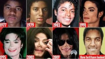 شاهد .. مايكل جاكسون خضع لـ 100 عملية تجميل وجرعة زائدة أنهت حياته