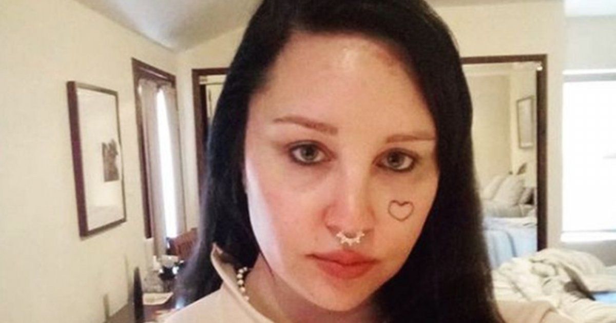 شاهد .. بالصور - أماندا باينز تتخلص من الوشوم على وجهها وهكذا أصبح شكلها