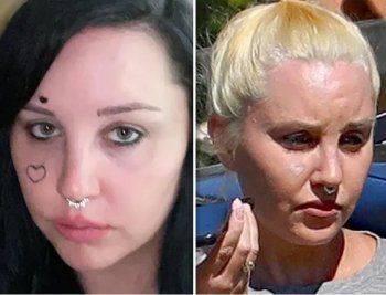 شاهد .. بالصور - أماندا باينز تتخلص من الوشوم على وجهها وهكذا أصبح شكلها