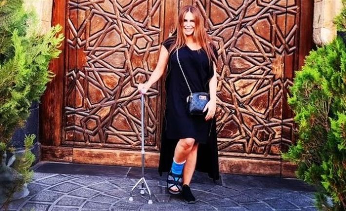 دينا عبد العزيز لبست جيبة قصيرة علشان توريك كسر رجليها : شاهد