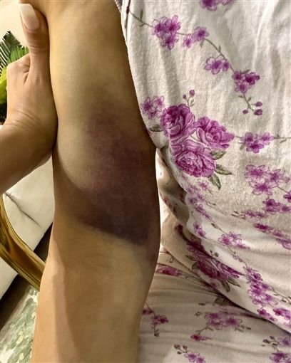 بالصور : والده منة فضالي هتعمل عملية خطيرة