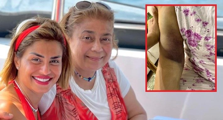 بالصور : والده منة فضالي هتعمل عملية خطيرة