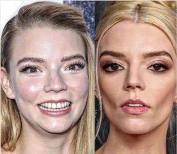 شاهد .. بالصورة- نجمة عالمية تصدم الجمهور بسبب شكلها