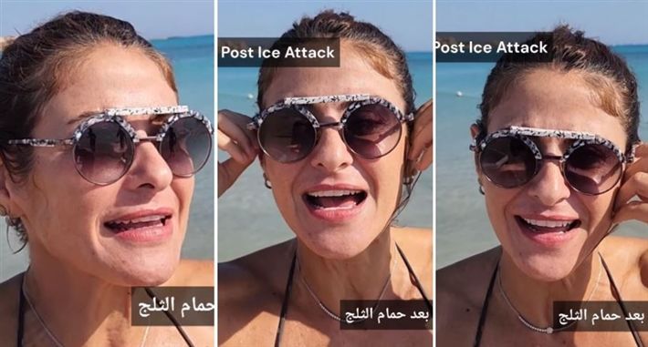 البكيني الجديد بتاع هيدي كرم اّخر حلاوة.. شاهد