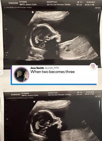 شاهد .. طفلة Teletubbies حامل بطفلها الأول وهكذا أصبح شكلها اليوم ! - بالصور