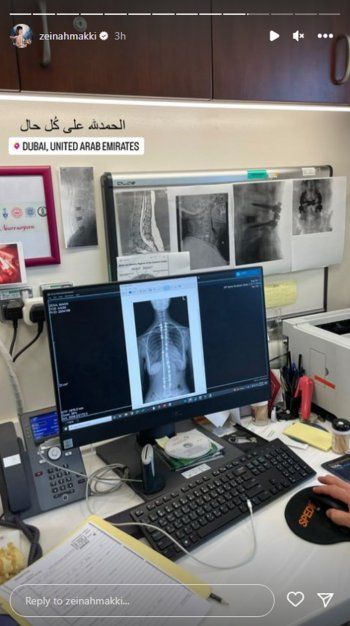 شاهد .. بالصور- من المستشفى.. زينة مكي تقلق الجمهور عليها