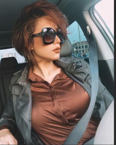 إصابة راندا عبد السلام بحروق من الدرجة الأولي : ألف سلامة