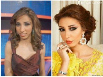 شاهد .. صور قديمة لـ دنيا بطمة تكشف المستور.. هكذا كان شكلها!!َ