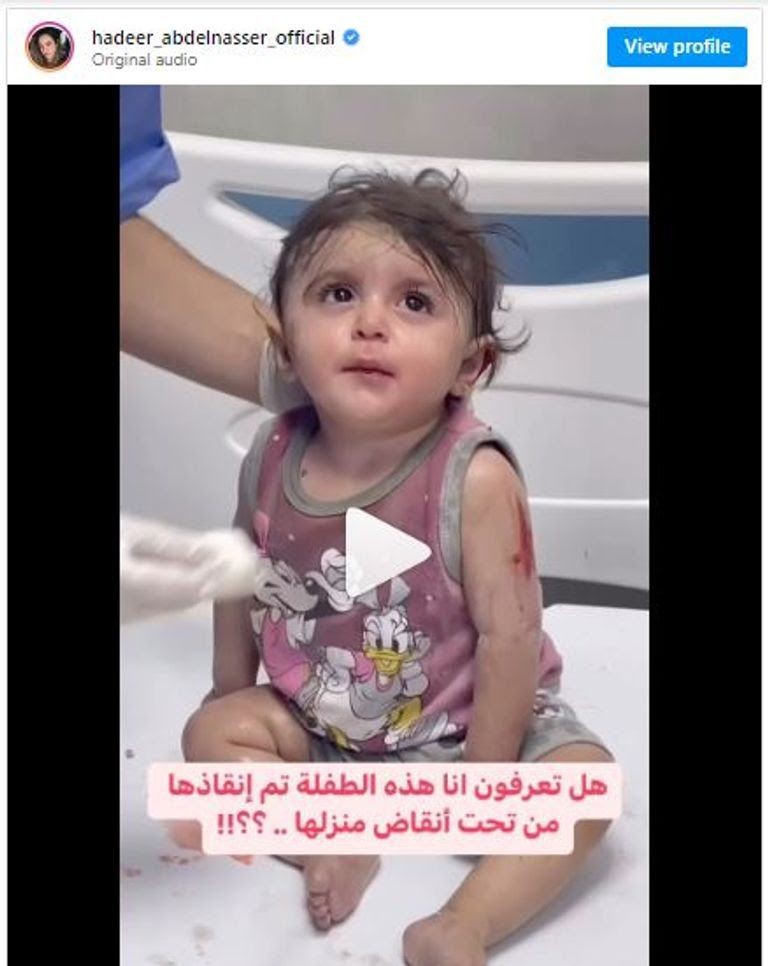 الممثلة هدير عبد الناصر تطلب تبنّي “رضيعة غزة الناجية”