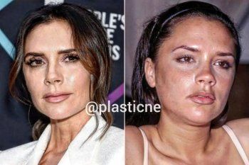 شاهد .. بالصور- نجمة عالمية تصدم الجمهور بشكلها السابق