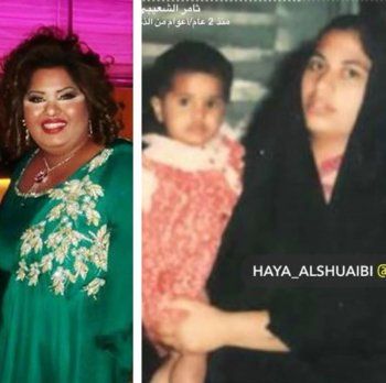 شاهد .. مي العيدان تثير الجدل بنشرها صورة لـ هيا الشعيبي قبل عمليات التجميل