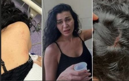 نادين الراسي خدت علقة محترمة من أخوها ووالدتها تدخل المستشفي – تفاصيل