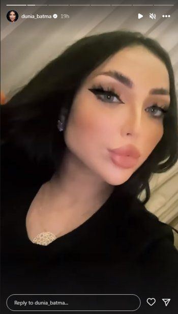 شاهد .. بالصور- بلوك راضي رائع.. دنيا بطمة تتألق بأخر ظهور لها