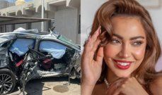 شاهد .. بالصور- مقدم برامج عالمي كاد أن يفقد بصره خلال البث المباشر.. هذا ما حصل معه