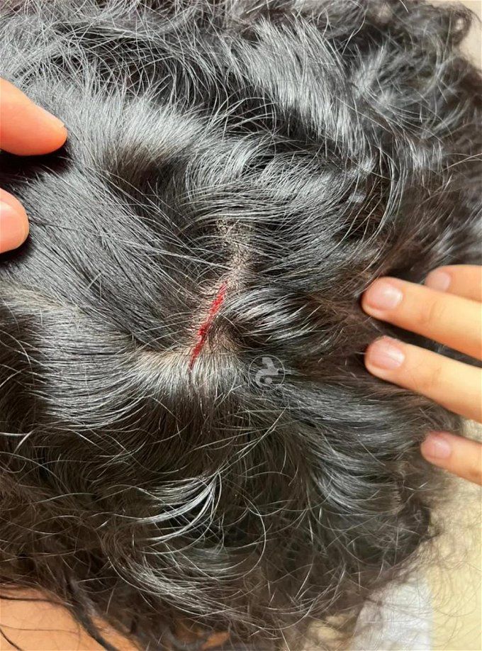 جروح وانهيار عصبي.. تفاصيل ضرب نادين الراسي من شقيقها الأصغر