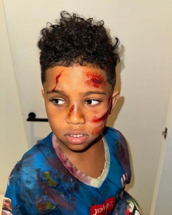 شاهد .. حملة هجومية واسعة تتعرض لها كيم كارداشيان.. هل سخرت من أطفال فلسـ طين؟