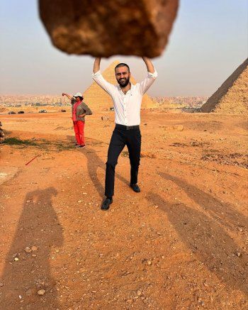 شاهد .. بعد خضوعه لعملية جراحية خطرة.. الشيف بوراك بأول ظهور بهذا البلد