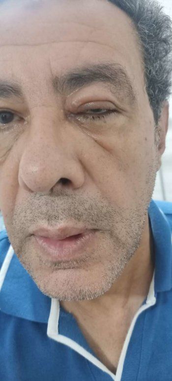 شاهد .. ممثل مصري يتعرض لوعكة صحية ويطلب الدعاء له بالشفاء