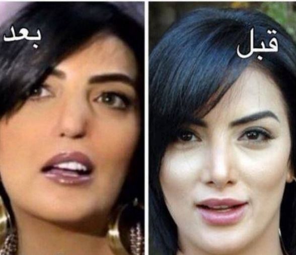 حورية فرغلي تضرب مثال حي للصبر : تحولت 180 درجة بسبب مناخيرها