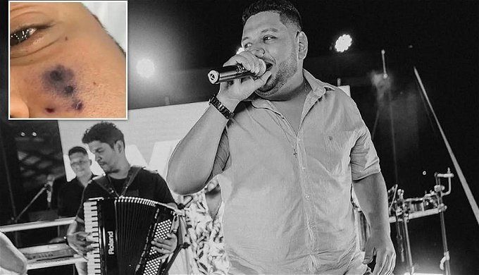 وفاة المطرب البرازيلي دارين مواريس بسبب لدغة ثعبان