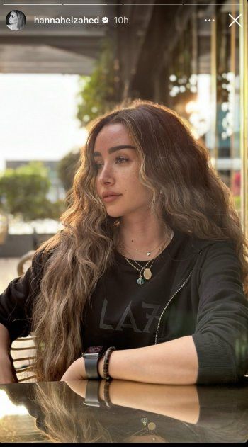 شاهد .. بالصورة - جمال وأنوثة هنا الزاهد يسحر العيون ويخطف قلوب الجمهور