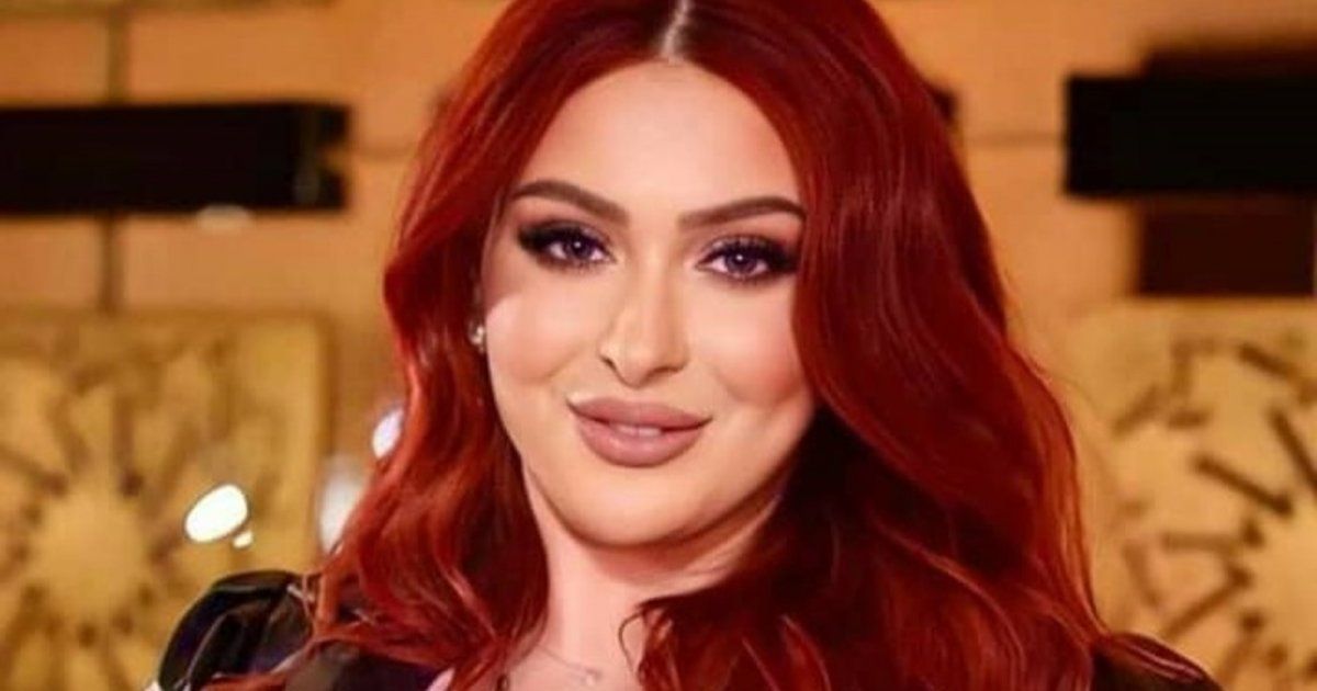 شاهد .. فرح يوسف تختار لوناً صادماً لشعرها ولهذا بدت شفتاها غريبتان-بالصور