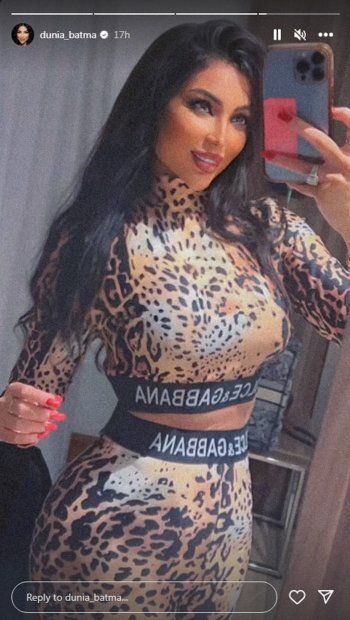 شاهد .. بالصور- بملابس النمر..دنيا بطمة تستعرض رشاقة جسمها بلوك مميز