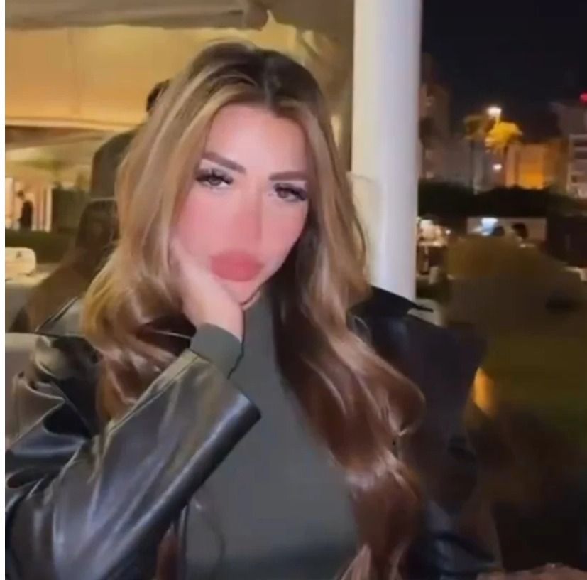 البوتوكوس والفيلر بوظ وش سارة سلامة: ملامحها إختفت