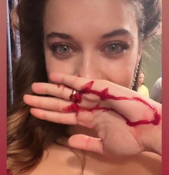 شاهد .. إصابة بطلة "الطائر الرفراف"..الد.م يُغطّي يدها-بالصورة