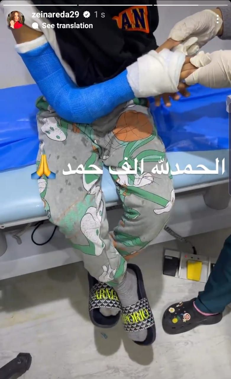 إصابة أحد توأم زينة بكسر في ذراعه