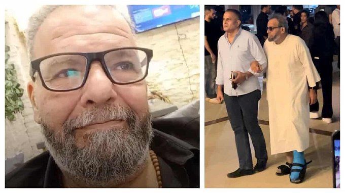 من هو المخرج أحمد البدري الذي تعرض لبتر قدمه؟.. قريب أحد المشاهير