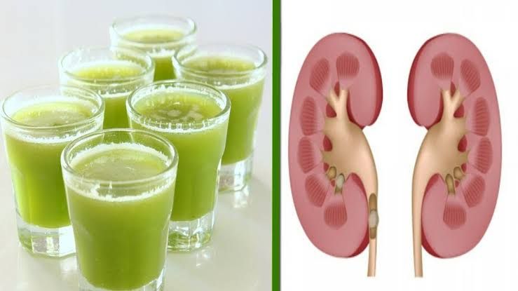 تنظيف الكلى من السموم.. مشروبات سحرية احرص عليها