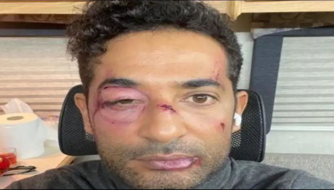 الغربان ضربوا عمرو سعد وشوهوا وجهه