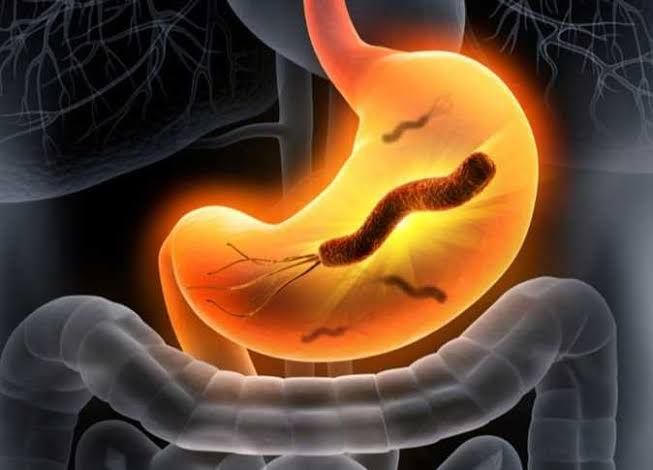 جرثومة المعدة.. أسبابها وروشتة علاج تغنيك عن زيارة الطبيب