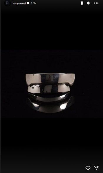 شاهد .. بالصور- كانيي ويست يحصل على أكسسوار غريب بسعر خيالي جداً..وهذا ما فعله بأسنانه