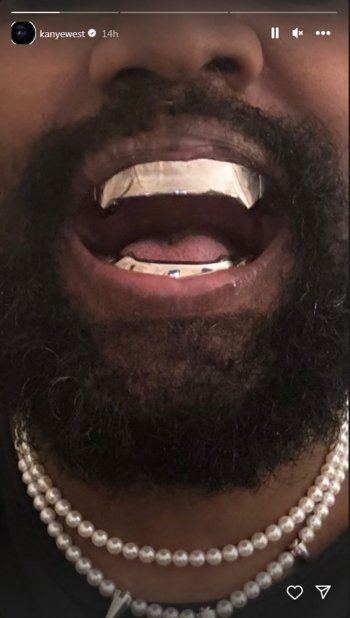 شاهد .. بالصور- كانيي ويست يحصل على أكسسوار غريب بسعر خيالي جداً..وهذا ما فعله بأسنانه
