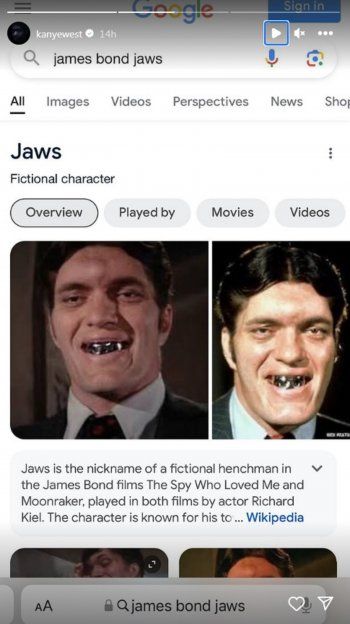 شاهد .. بالصور- كانيي ويست يحصل على أكسسوار غريب بسعر خيالي جداً..وهذا ما فعله بأسنانه