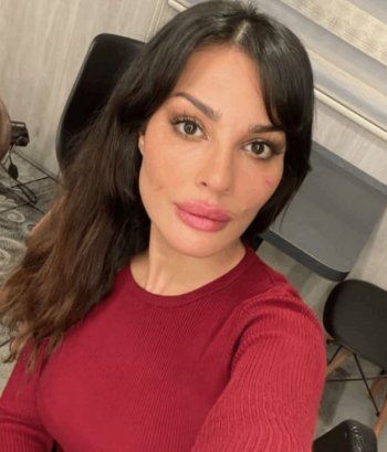 شاهد .. جروح على وجه نادين نسيب نجيم تثير قلق الجمهور.. وهذا ما حدث